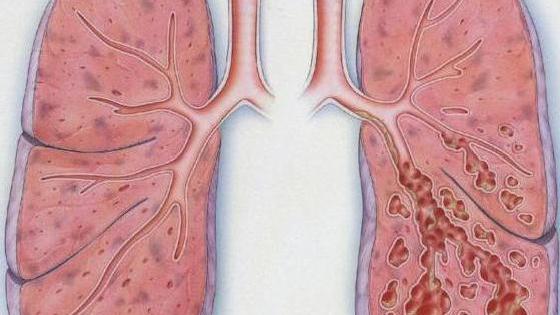 Hammomdagi ayollar fotosuratlari Uyda yalangoch külotlu porno