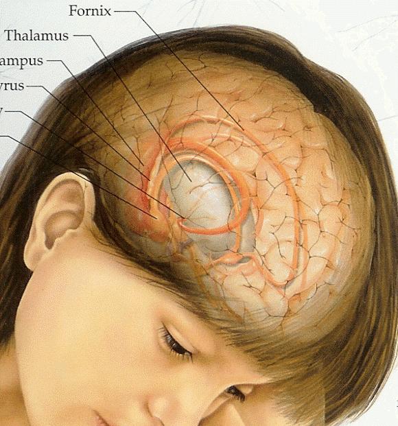 Otak tumor: gejala pada peringkat awal. Tanda-tanda awal tumor otak