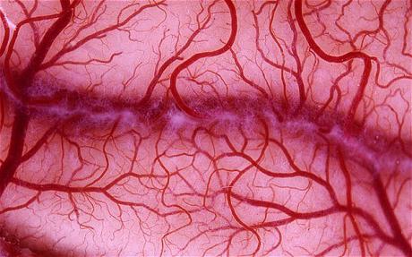 التهاب الأوعية الدموية: الأعراض والعلاج. التهاب الأوعية الدموية - ما هو هذا المرض؟