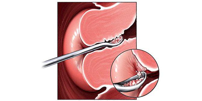 Kelinlar birinchi kechada jinsiy aloqa qilishlari