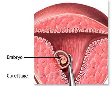 Er uchun trans porno video