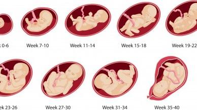 Usia Kandungan Obstetrik Dan Sebenar Menentukan Umur Gestasi Oleh Ultrasound