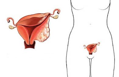 Kanser rahim tanda pangkal Ketumbuhan Pangkal